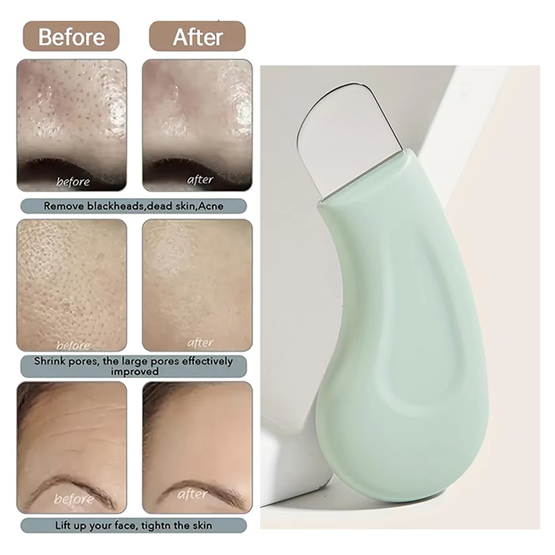أداة تنظيف عميق للوجه لإزالة ا - مراجعة Nasal Aspirator وسعره